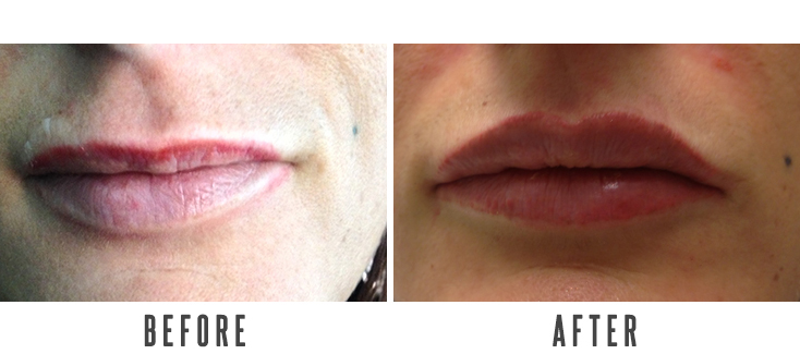 SKIN AGEING PREVENTION AND WRINKLES CORRECTION